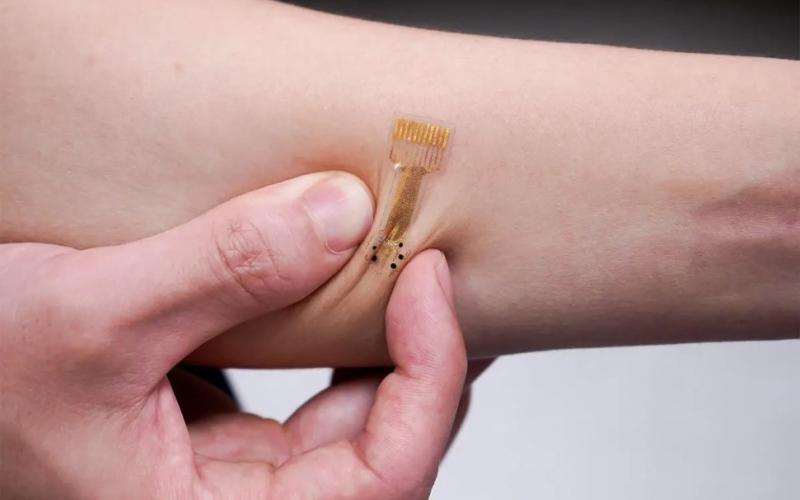 “Smart” Bandages: A Cheaper, Easier, and More Effective Way To Treat Chronic Wounds